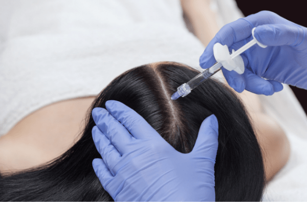 Anti hair loss medical mesotherapy - La Maison Spa