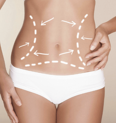 Lipo Cell Crio Paquete 6 sesiones